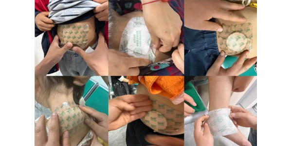 初夏不预防，盛夏徒伤悲：这些问题现在贴敷正好！